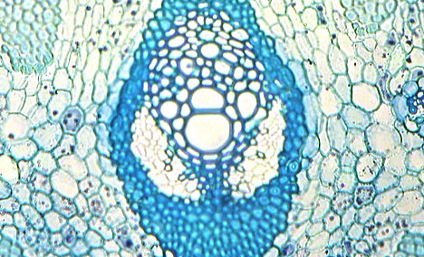 Microscopic Plant Cells